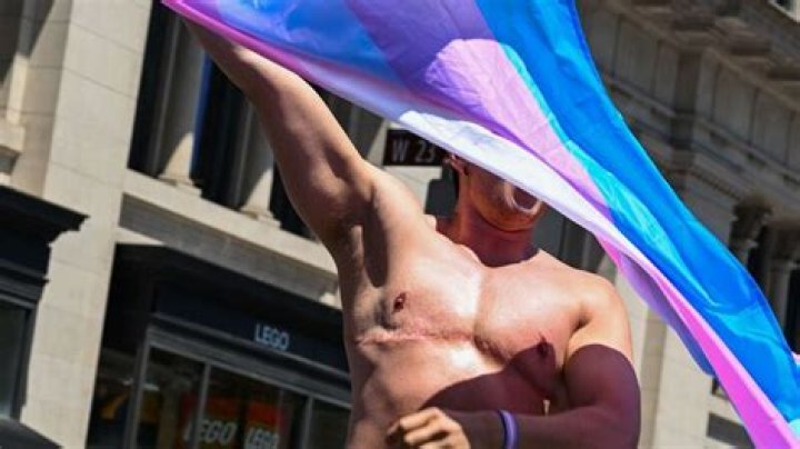 New Study Finds: Top Surgery With Minimal Regret