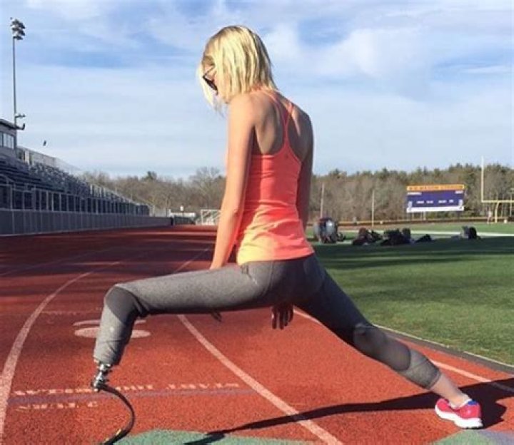 Adrianne Haslet-Davis: Inspiring Dancer And Disability Advocate