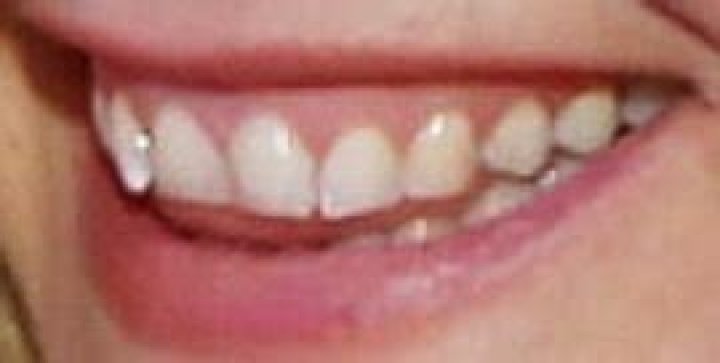 Alicia Silverstone: Uncovering The Secrets Of Her Pearly Whites