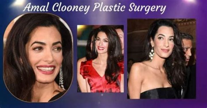 Amal Clooney's Transformative Plastic Surgery Journey: Uncovering The Truth