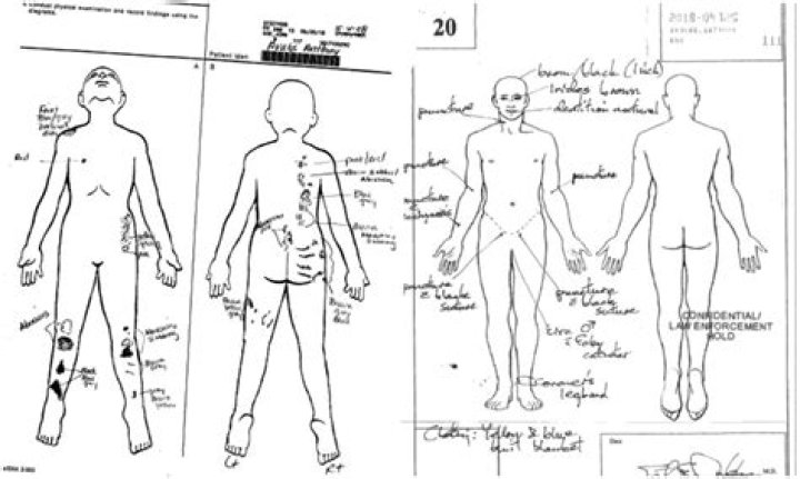 Unveiling The Tragic Truth: Anthony Avalos Autopsy Report