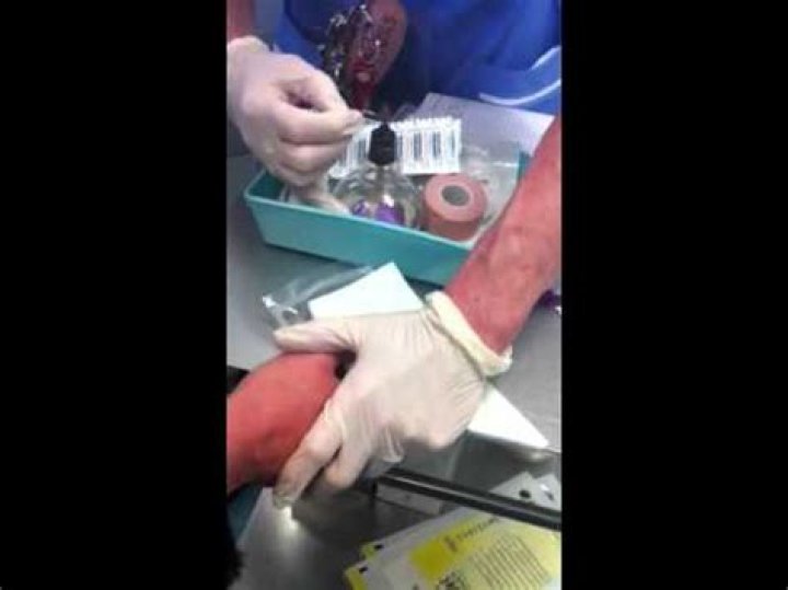 The Ultimate Guide To The Black Man Pinch: Techniques, Benefits, And More