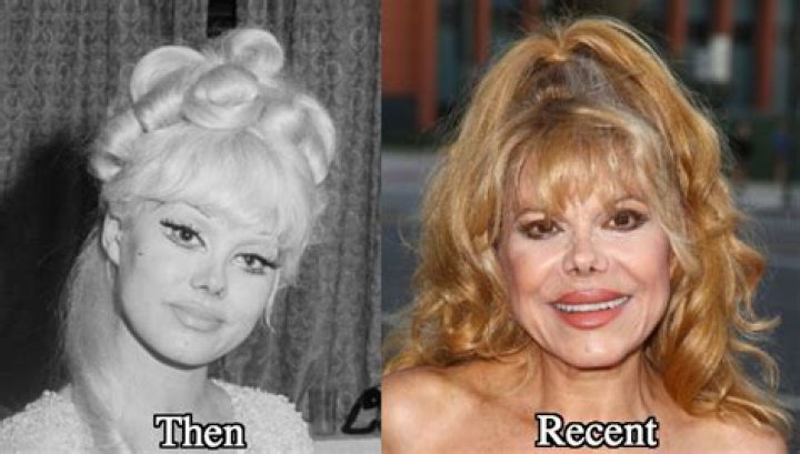 Get To Know Charo's Transformation: Before The Surgery