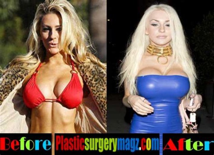 BIGGER Breast Implants In New Instagram Photos?