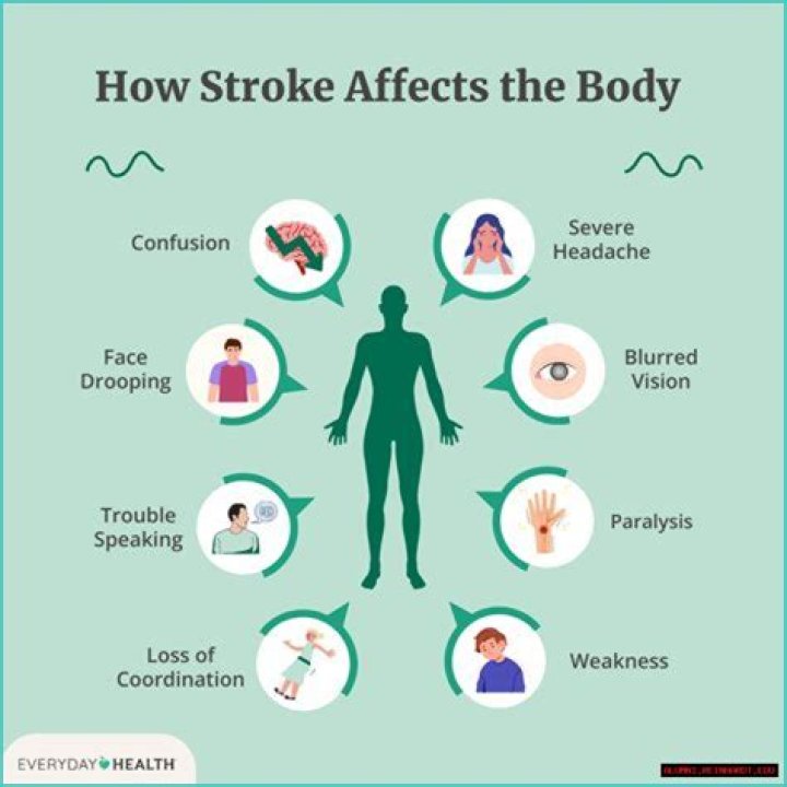 Did Joyce Vance Suffer A Stroke? Here's The Truth