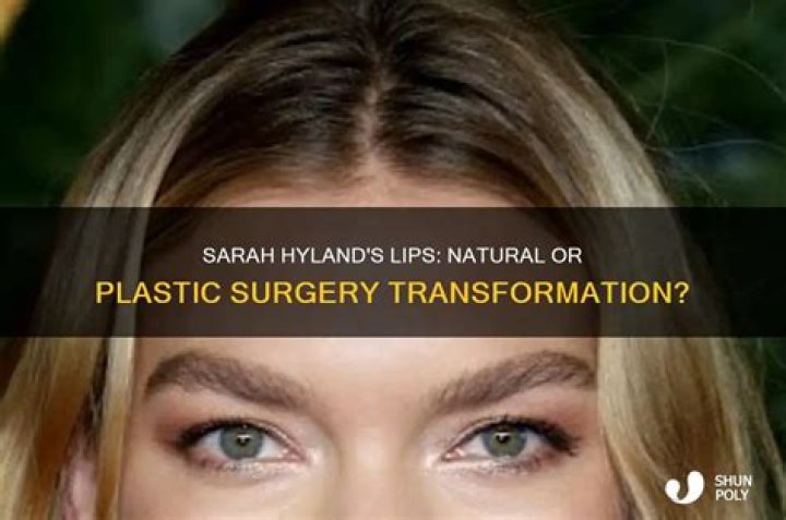 Sarah Hyland's Plastic Surgery Journey Revealed