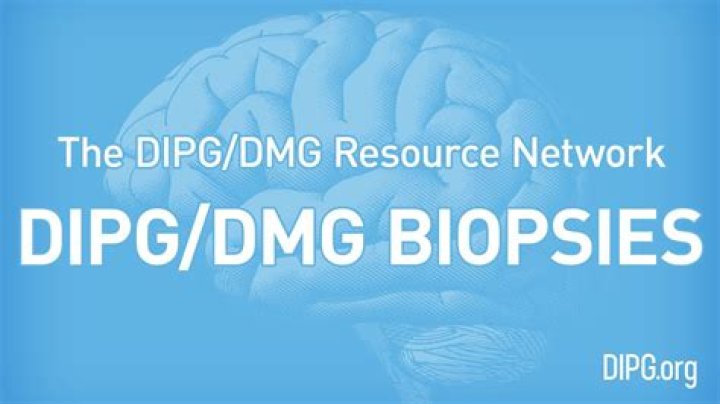 DIPG Vs. DMG: What's The Difference?