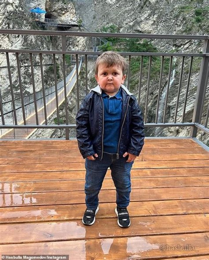 Unlocking The Mysteries Of Hasbulla Condition: Discoveries And Insights