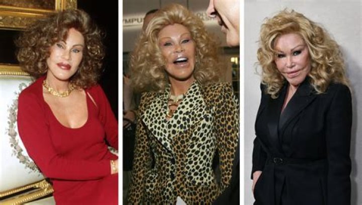 Unveiling The Enigmatic World Of Jocelyn Wildenstein: Beauty, Identity, And Transformation