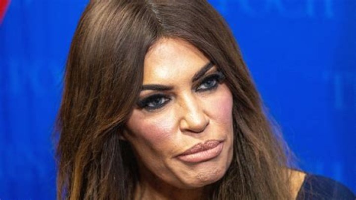 The Truth Uncovered: Kimberly Guilfoyle's Mouth Examination