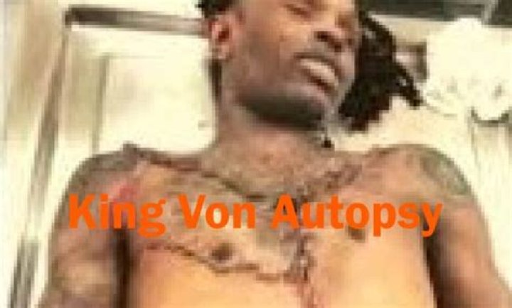King Von's Autopsy Report: A Detailed Analysis