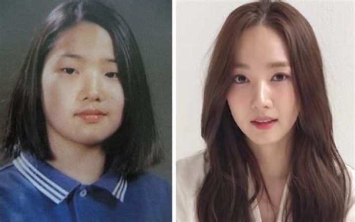 Top 10 Korean Actresses With Plastic Surgery: Beauty Or Burden?