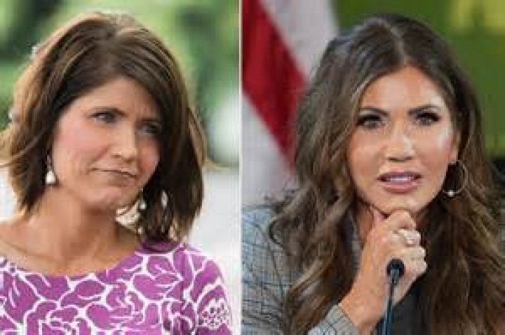Revisiting Kristi Noem's Appearance Before Cosmetic Surgery