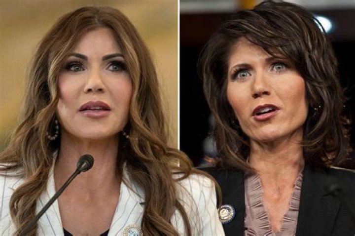 Unrecognizable: Kirsti Noem's Pre-Surgery Transformation
