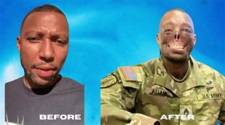 Uncovering The Truth Behind Randy Adams' Face Accident: Unveiling Hidden Insights