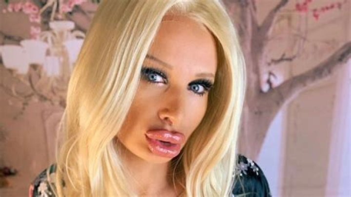 Sophie Anderson, Star Of Viral Sensation, Passes Away At 36