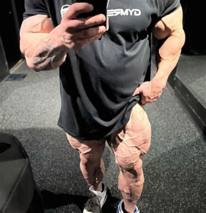 Nick Walker Proudly Shows Off Insanely Vascular Legs Ahead of Arnold Classic2023
