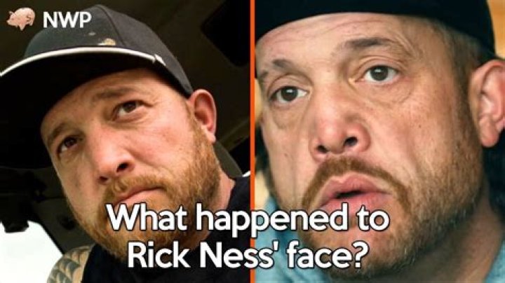 Unveiling The Mysterious Injury: Rick Ness's Facial Trauma
